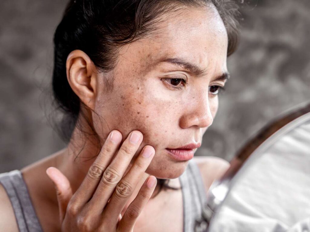 How To Use Licorice Root Extract To Improve Hyperpigmentation 1