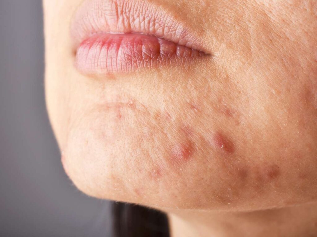 8 Benefits of Centella Asiatica for Your Skin 3