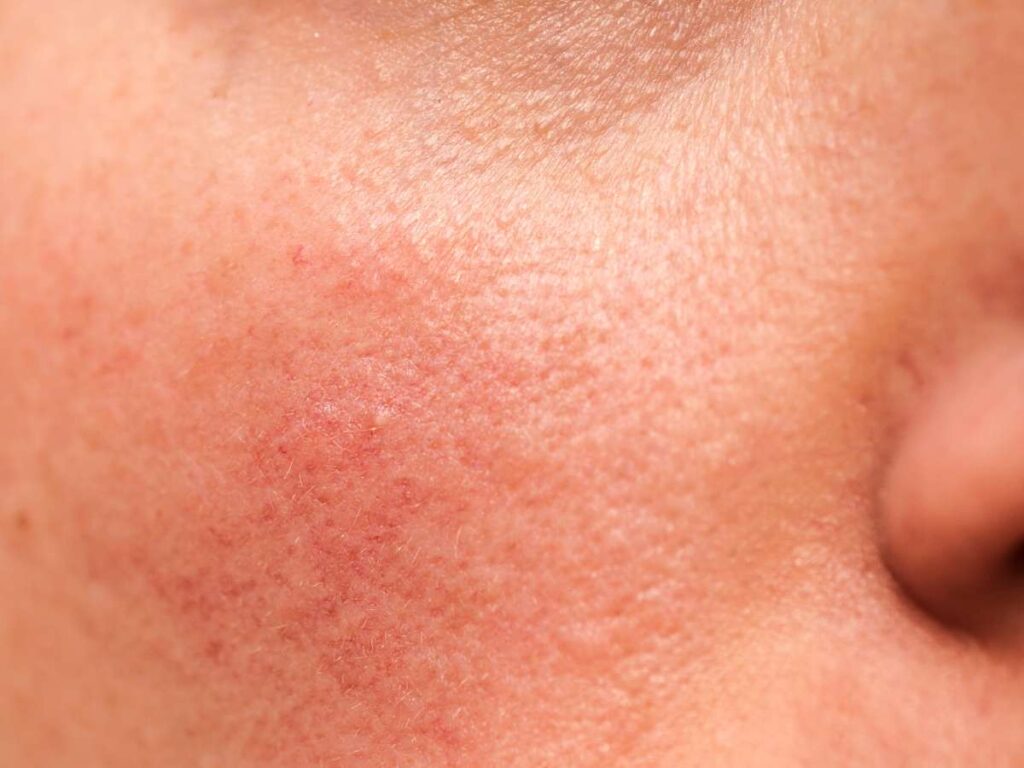 8 Benefits of Centella Asiatica for Your Skin 6